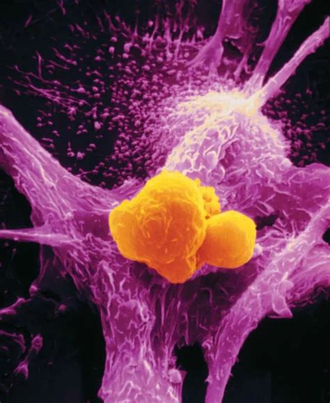 《自然》子刊：太狡猾！巨噬细胞为何屡屡被癌细胞征服，斯坦福免疫大牛揭开癌细胞第二个 不要吃我 信号 科学大发现 X Mol资讯