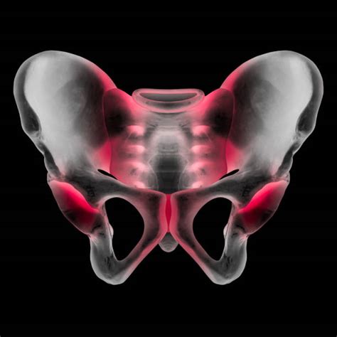 10 Iliac Tubercle Stock Photos Pictures And Royalty Free Images Istock