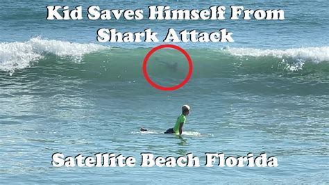 Kid Saves Himself From Shark Attack In Florida