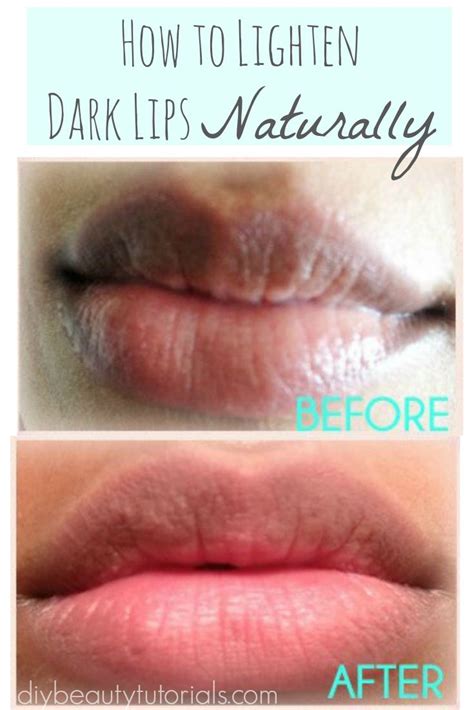 Diy How To Lighten Dark Lips Naturally Remedies For Dark Lips