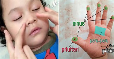 Penting untuk dicatat bahwa hidung tersumbat( hidung tersumbat) dan hidung meler( rinitis) hanyalah gejala. Teknik Urutan Mudah Untuk Redakan Bayi Dengan Masalah ...