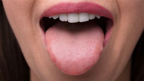 What You Need To Know About Covid Tongue And How Coronavirus Affects
