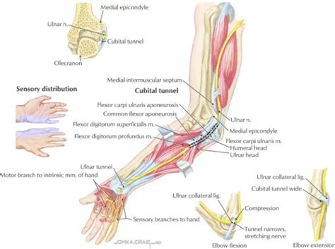 Radial Nerve Injury Causes Symptoms Treatment Rxharun