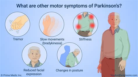 Understanding Parkinsons Disease Artofit