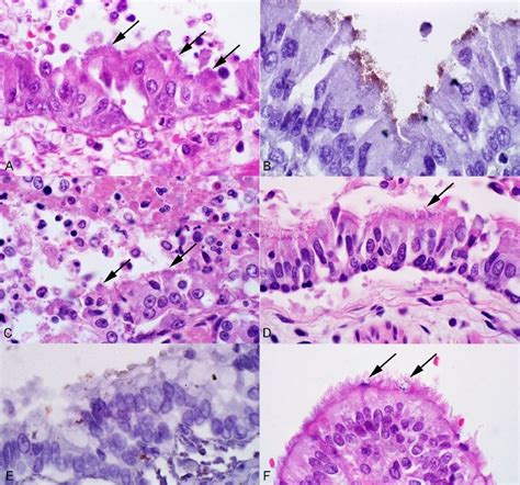 The symptoms of the disease can be mistaken for a wide variety of other upper respiratory what causes feline bordetella infection? Bordetella bronchiseptica pneumonia in dogs (A, B, D-F ...
