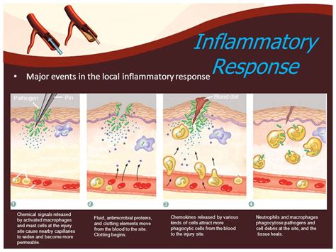 Inflammatory Response Flow Chart