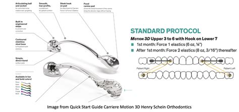 Carriere® Motion Appliance Does It Work Orthodontics In Summary