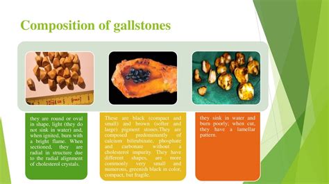 Gallstones Cholelithiasis Online Presentation