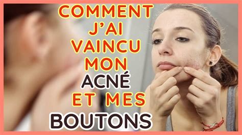 Jai Vaincu Mon Acne Mes Boutons Et Mes Problemes De Peau Voici Comment Jai Fait Youtube