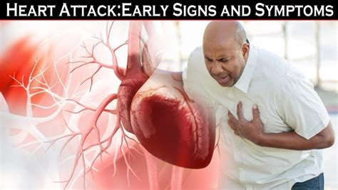 Do You Know The Warning Signs Of Heart Stroke Symptoms Of Heart