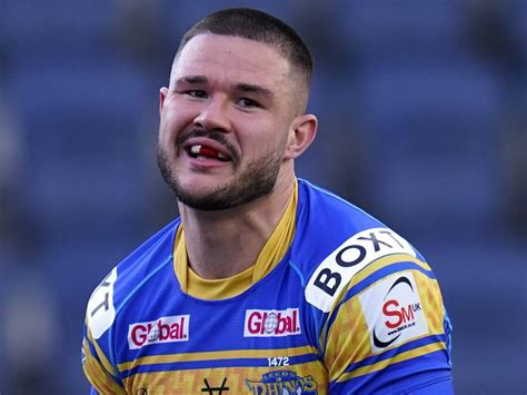 Victor Radley Investigated Over Alleged Headbutt In Rugby League World