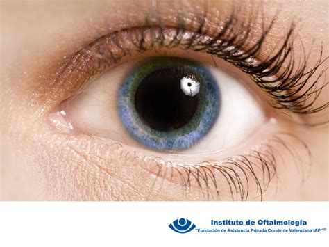 CirugÍa De Cataratas En Un Examen Completo De Los Ojos Con Dilatación De La Pupila Un