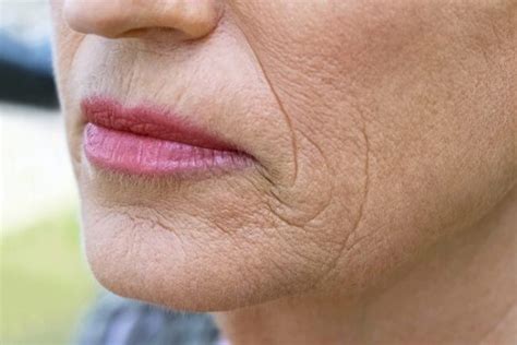 The Types Of Skin Aging And How To Identify Them