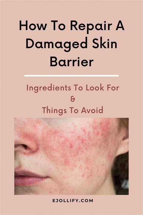 9 Tips On How To Repair Damaged Skin Barrier Damaged Skin Repair Healing Facial Skin Skin Facts