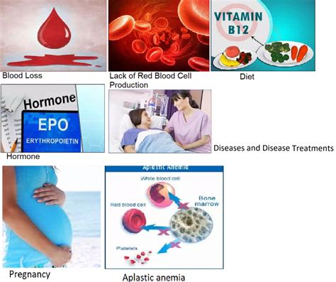Causes Of Anemia