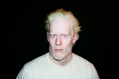 Picture Of Stephen Thompson Model In 2022 Stephen Thompson Albino