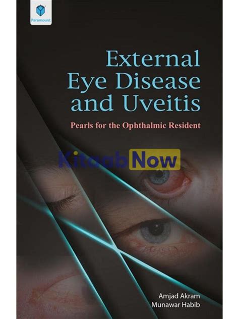 External Eye Disease And Uveitis Pearls For The Ophthalmic Resident