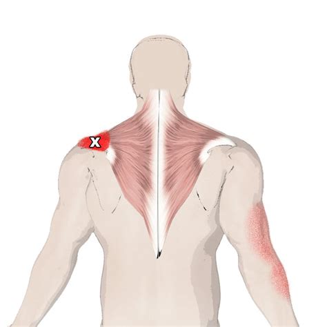 The Trapezius Muscle This Months Muscle Of The Month Yoga Anatomy