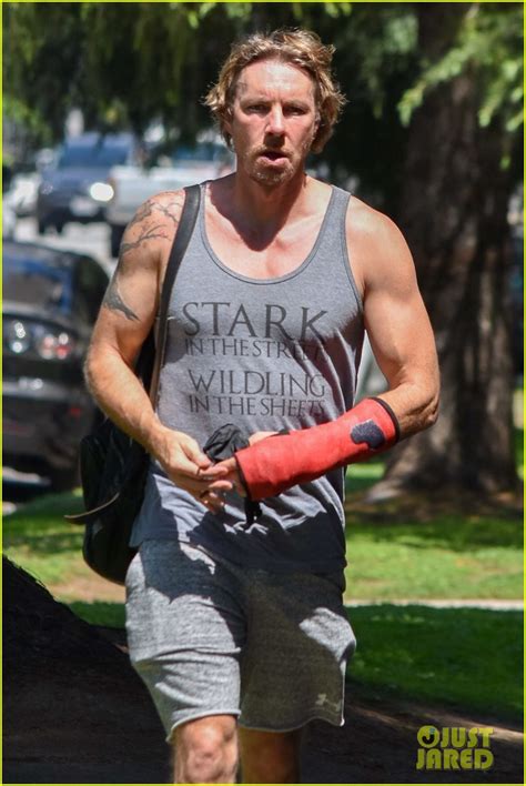 Photo Dax Shepard Steps Out Wearing A Cast Photo Just Jared Entertainment News