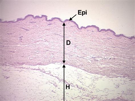 Human Skin Cells Under Microscope 40x Micropedia