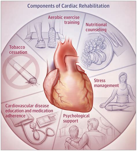 Should I Participate In A Cardiac Rehabilitation Program Acute