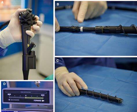 Motorised Spiral Enteroscopy First Prospective Clinical Feasibility