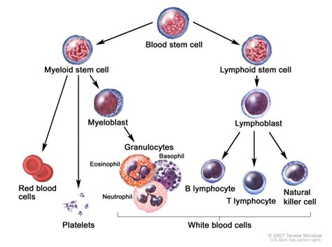 acute lymphoblastic leukemia pathophysiology