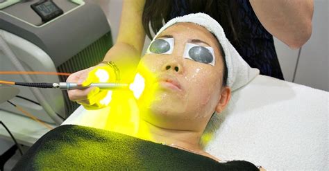 What Is Yellow Laser Toronto Fairview Laser Clinic Inc