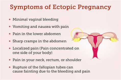 Ectopic Pregnancy Causes Symptoms Treatments And More