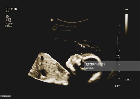 Baby Ultrasound High Res Stock Photo Getty Images