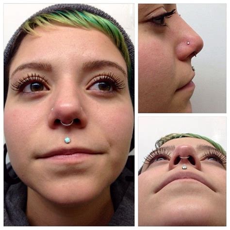 Downsized Alexs Philtrum Piercing One Last Time And Installed A Seam