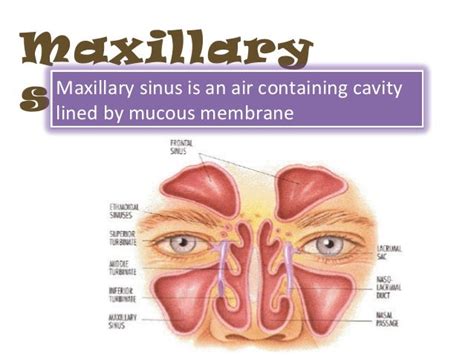 Right Maxillary Sinus Disease Maxillary Sinus Disease Pptx Diseases