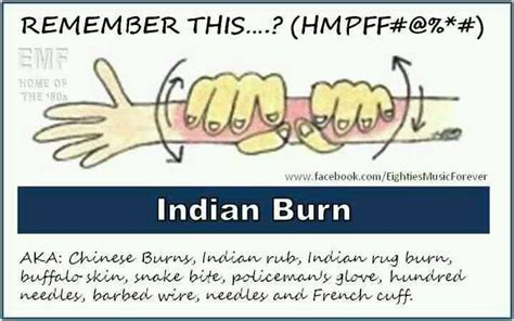 Indian Burn The Good Old Days Burns School Memories