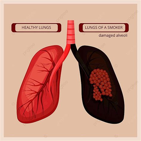 Smoker Lungs Lung Cancer Infographic Poster Template Download On Pngtree