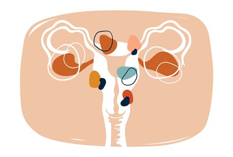 Understanding Uterine Fibroids Causes Symptoms And Treatment Options