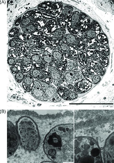 1 Ultrastructure Of A Toxoplasma Gondii Tissue Cyst In Vitro A This