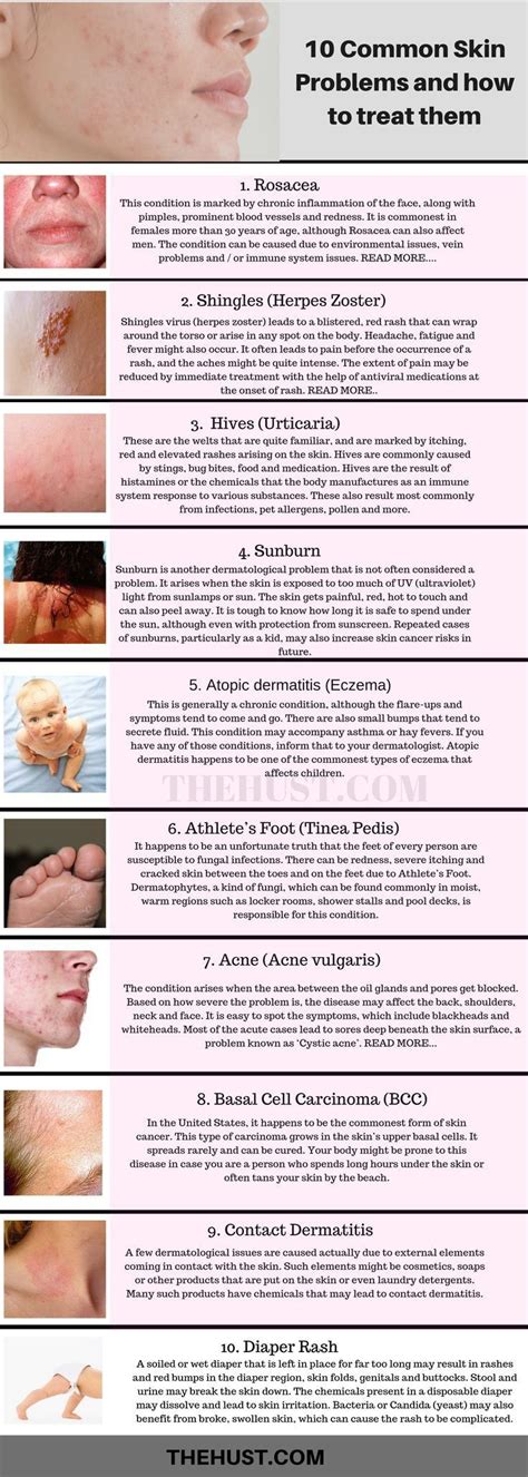 10 Common Skin Conditions And Problems Pictures And Treatments Skin