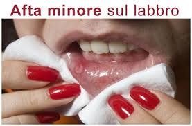 Stomatite e Infiammazione sulla Lingua e Bocca, Sintomi e ...