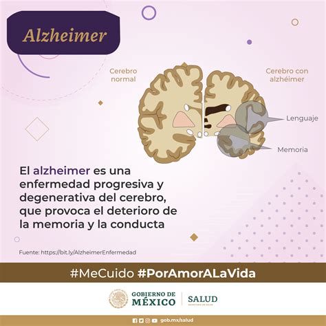 Enfermedad De Alzheimer Demencia Más Común Que Afecta A Personas