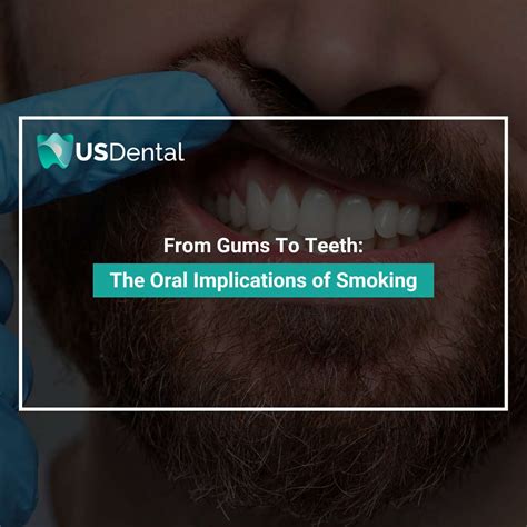 from gums to teeth the oral implications of smoking