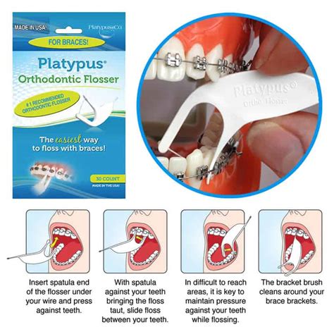 How To Floss With Braces Platypus 4 Ways To Floss With Braces Wikihow