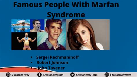 Famous People With Marfan Syndrome 2021 List Of Top 10 Marfan