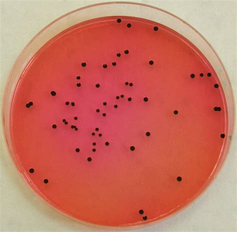 Examine he, xld, and bs plates for presence of colonies xld typical salmonella appear as opaque/yellow, pink, or red colonies with black centers. XLD agar