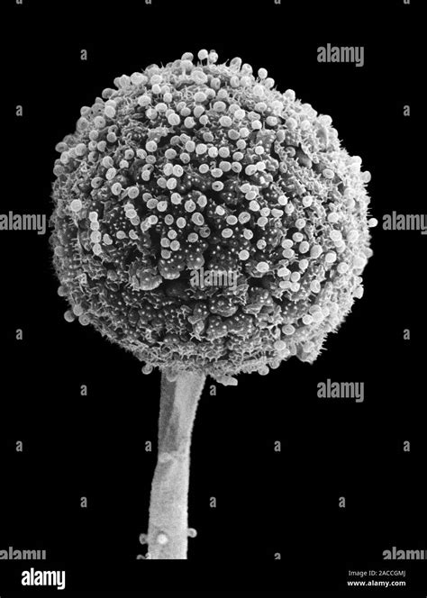 Scanning Electron Micrograph Of A Sporangium Or Fruiting Body Of A