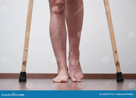 A Woman After A Broken Leg To Learn To Walk Rehabilitation After