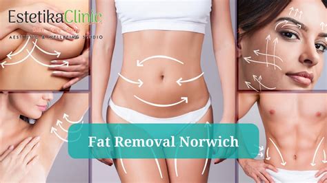 considering fat removal treatment by waves 21 estetika clinic