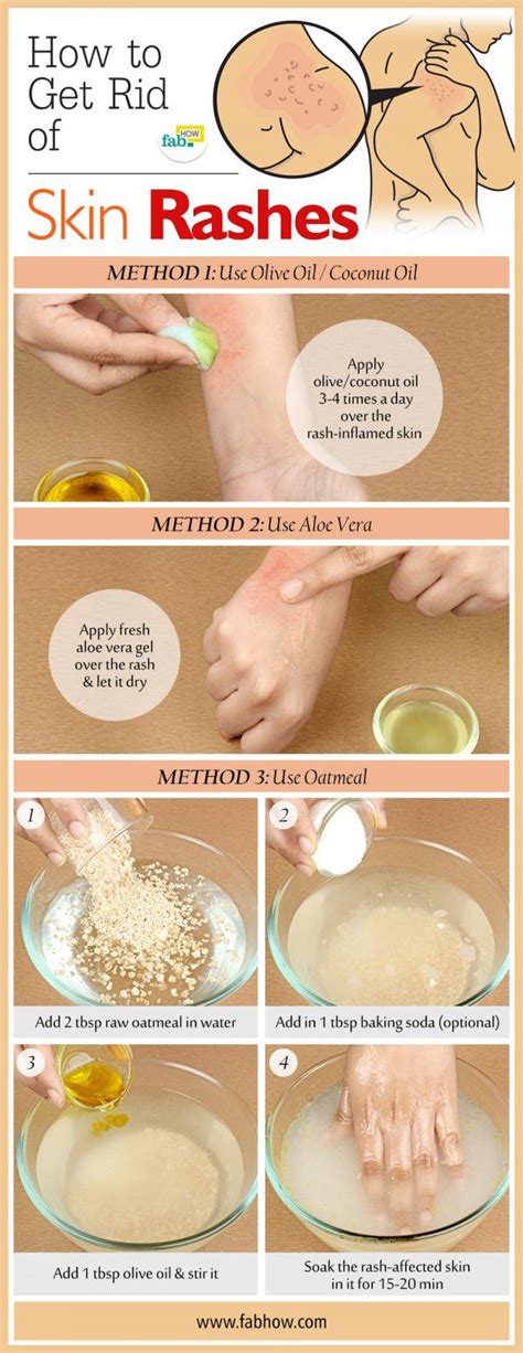 Home Remedies for Rashes | Fab How