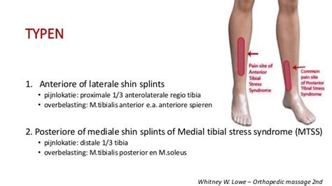 Medial Tibial Stress Syndrome Mtss