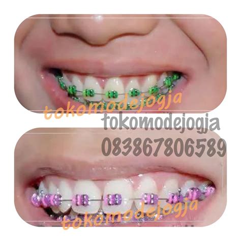 Check spelling or type a new query. Warna Karet Behel Yang Cocok Untuk Pria