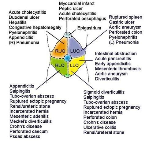 Abdominal Pain Quadrants Disorders Some Call It A Career I Call